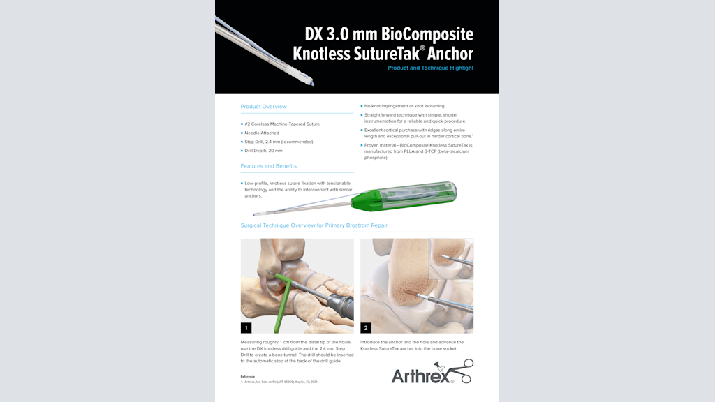 DX 3.0 mm BioComposite Knotless SutureTak® Anchor