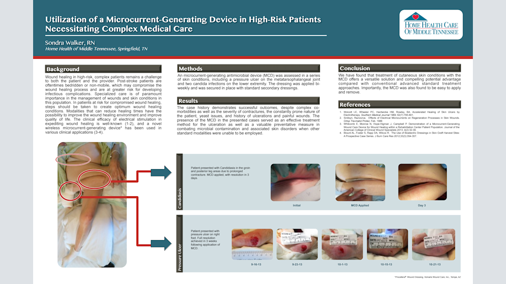 Utilization of a Microcurrent-Generating Device in High-Risk Patients Necessitating Complex Medical Care