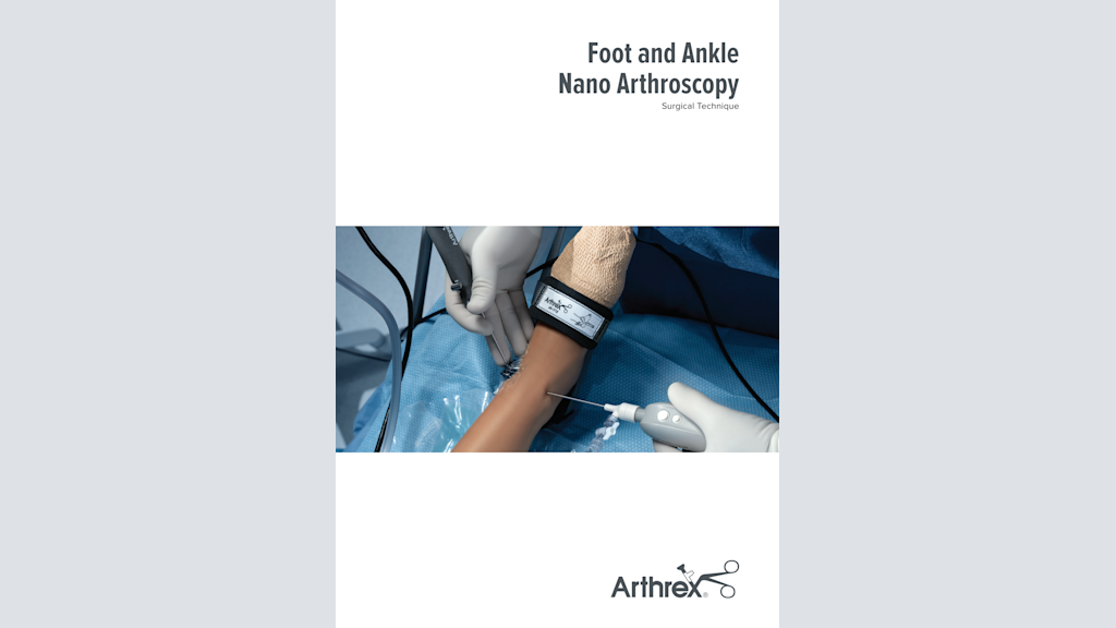Foot and Ankle Nano Arthroscopy