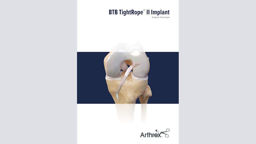 BTB TightRope® II Implant