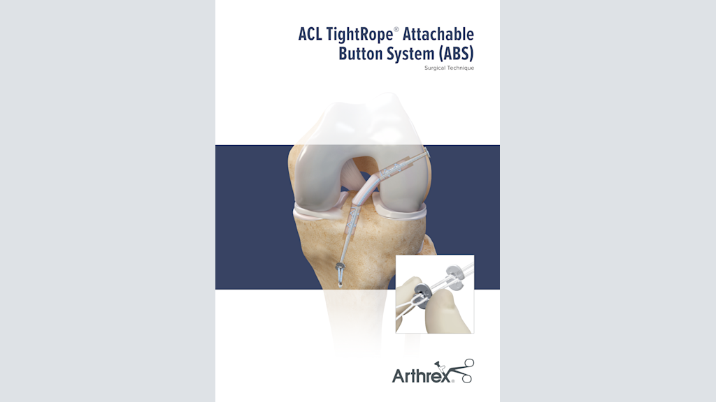 ACL TightRope® Attachable Button System (ABS)