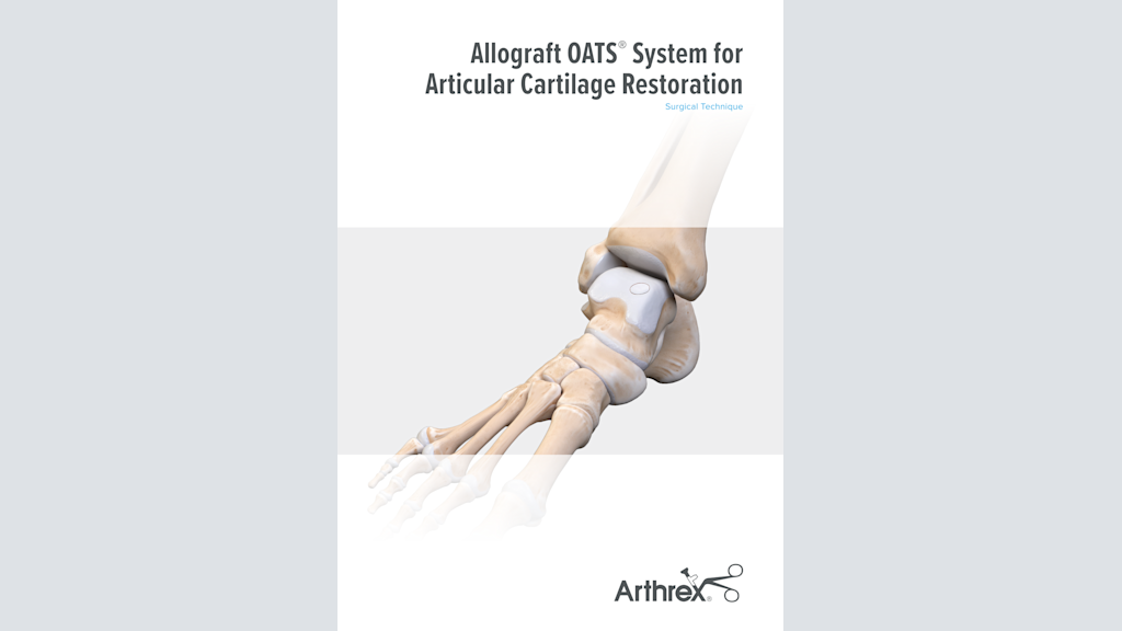 Allograft OATS® System for Articular Cartilage Restoration