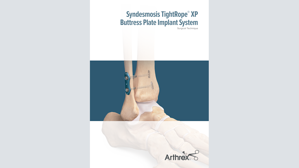 Syndesmosis TightRope® XP Buttress Plate Implant System