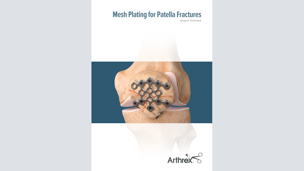 Mesh Plating for Patella Fractures