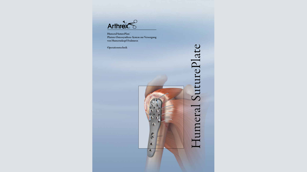 Arthrex Humeral SuturePlate™ - Platten-Osteosynthese-System zur Versorgung von Humeruskopf-Frakturen
