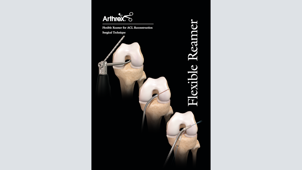 Flexible Reamer for ACL Reconstruction