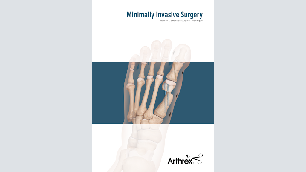 Minimally Invasive Surgery - Bunion Correction Surgical Technique