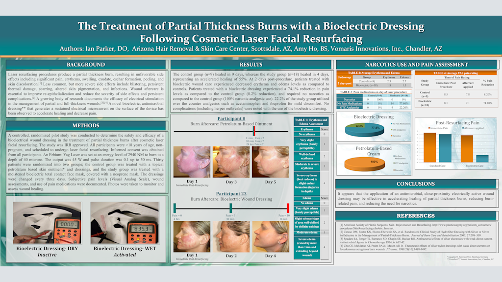 The Treatment of Partial Thickness Burns with a Bioelectric Dressing Following Cosmetic Laser Facial Resurfacing