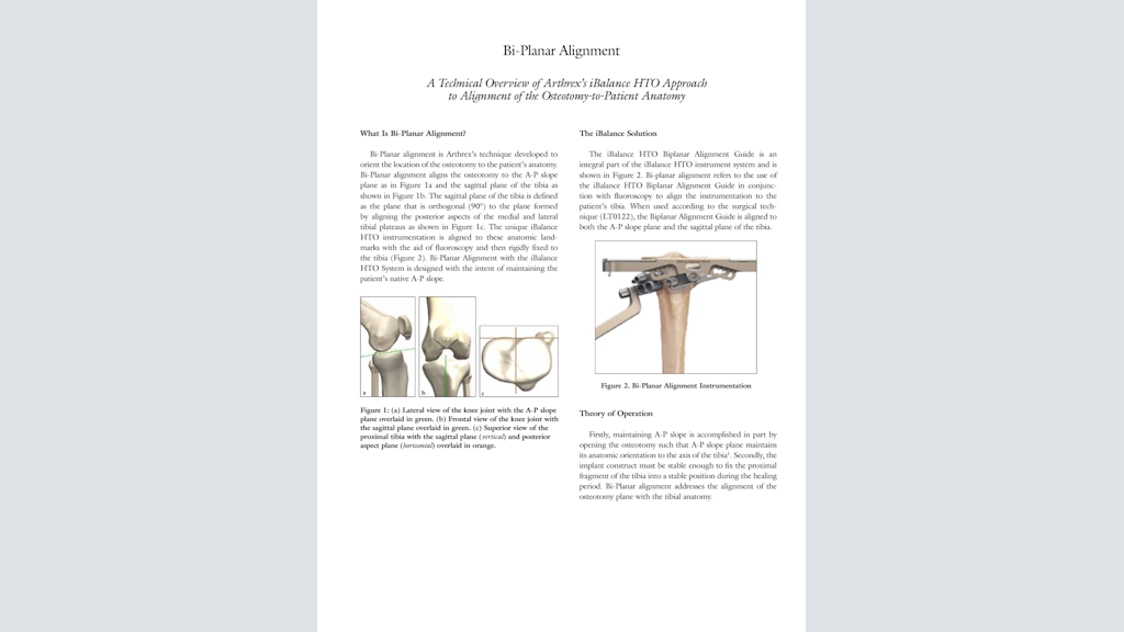 Bi-Planar Alignment: A Technical Overview of Arthrex’s iBalance® HTO Approach to Alignment of the Osteotomy-to-Patient Anatomy