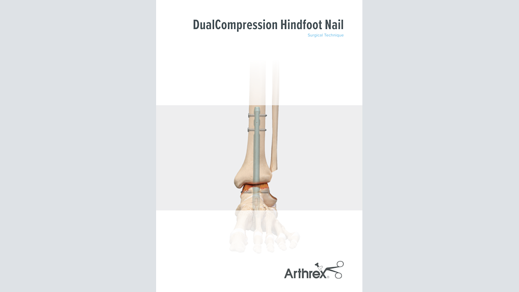 DualCompression Hindfoot Nail