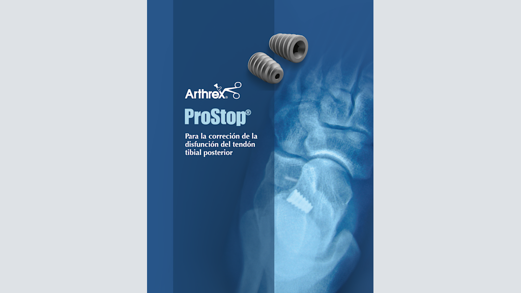 ProStop® - Para la correción de la disfunción del tendón tibial posterior