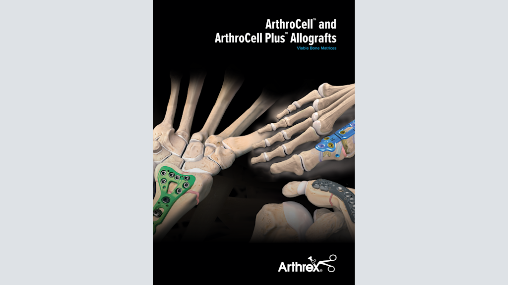 ArthroCell™ and ArthroCell Plus™ Allografts - Viable Bone Matrices