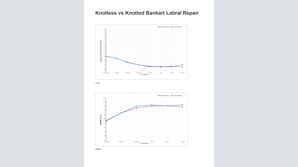 Knotless vs Knotted Bankart Labral Repair