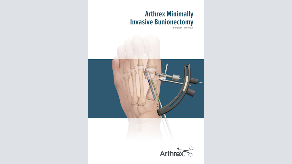 Arthrex Minimally Invasive Bunionectomy