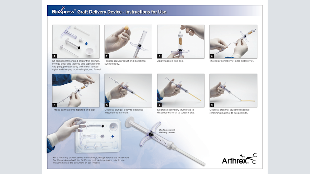 BioXpress™ Graft Delivery Device - Instructions for Use