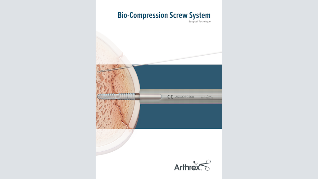 Bio-Compression Screw System