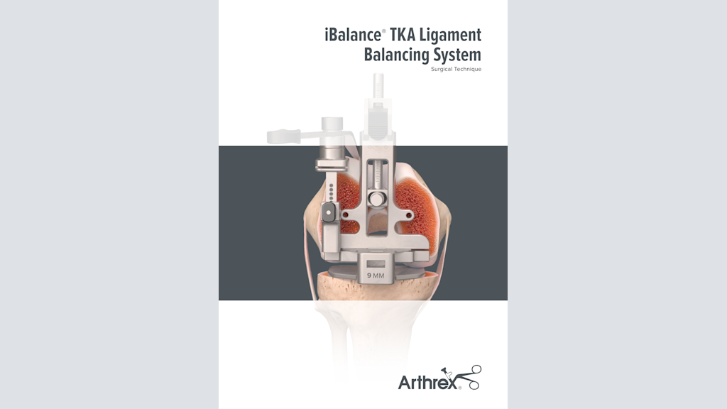 iBalance® TKA Ligament Balancing System