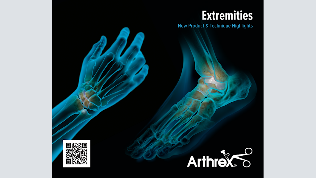 Distal Extremities New Product & Technique Highlights