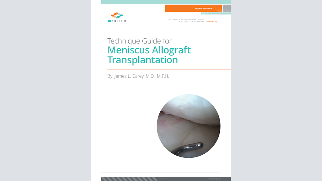 Meniscus Allograft Transplantation