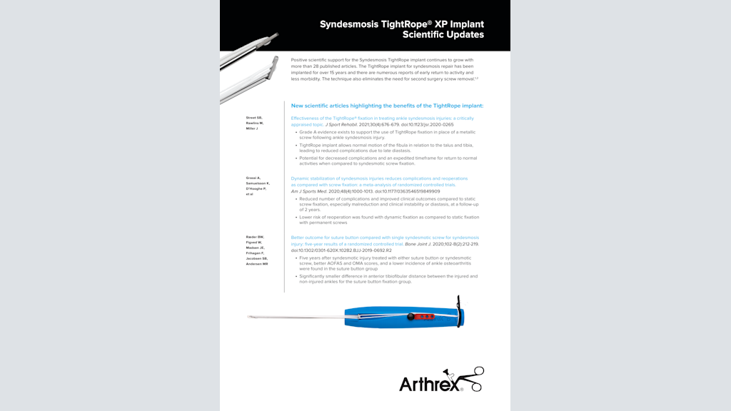 Syndesmosis TightRope® XP Implant Scientific Updates