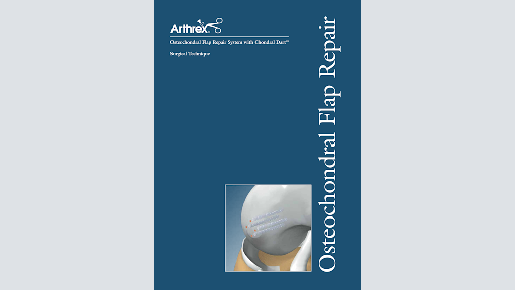 Osteochondral Flap Repair System with Chondral Dart™
