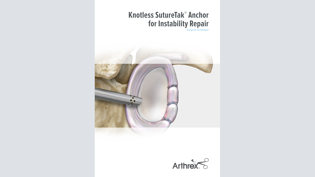 Knotless SutureTak® Anchor for Instability Repair