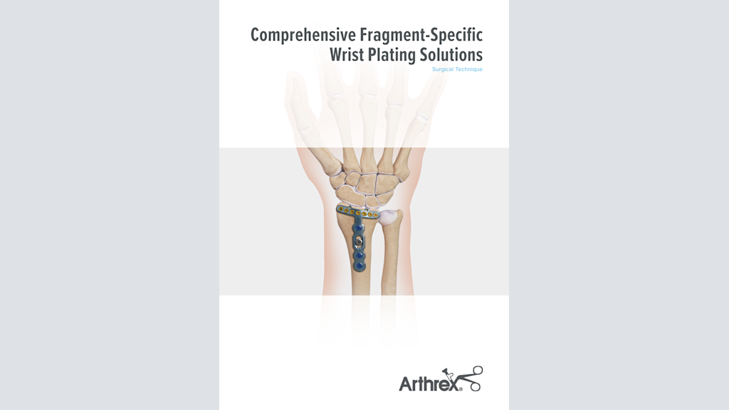 Comprehensive Fragment-Specific Wrist Plating Solutions