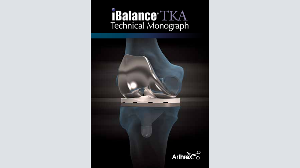 iBalance® TKA Technical Monograph