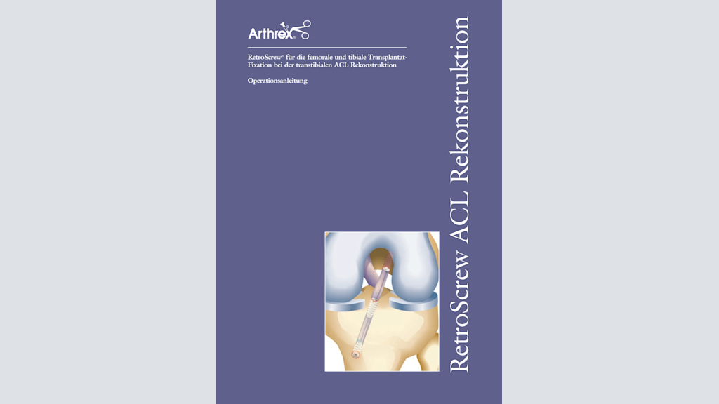 RetroScrew® für die femorale und tibiale Transplantat-Fixation bei der transtibialen ACL Rekonstruktion