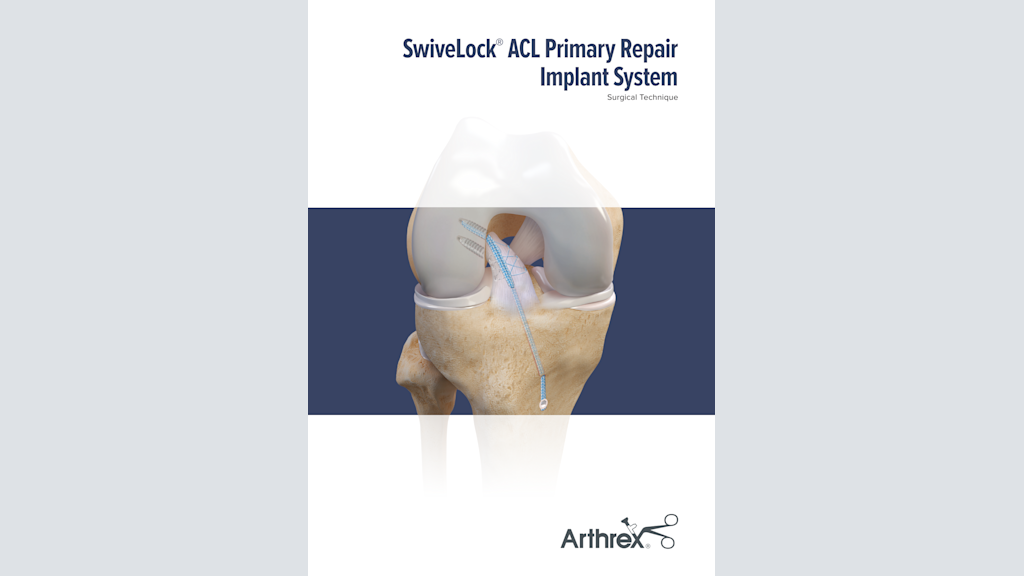 SwiveLock® ACL Primary Repair Implant System