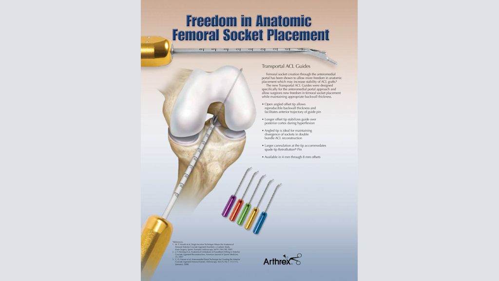 Freedom in Anatomic Femoral Socket Placement