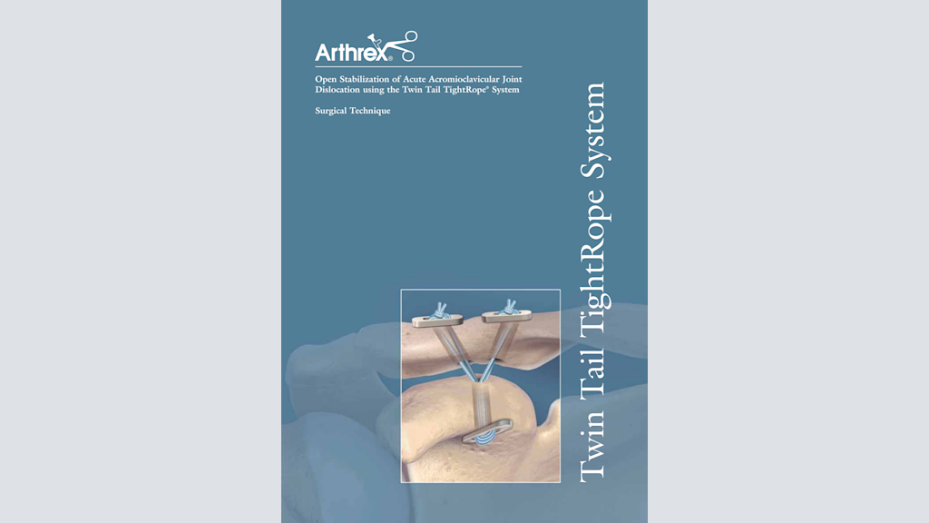 Open Stabilization of Acute Acromioclavicular Joint Dislocation using Twin Tail TightRope® System