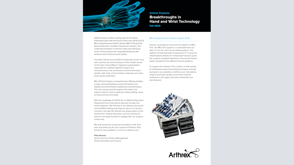 Arthrex Presents: Breakthroughs in Hand and Wrist Technology Summer 2020