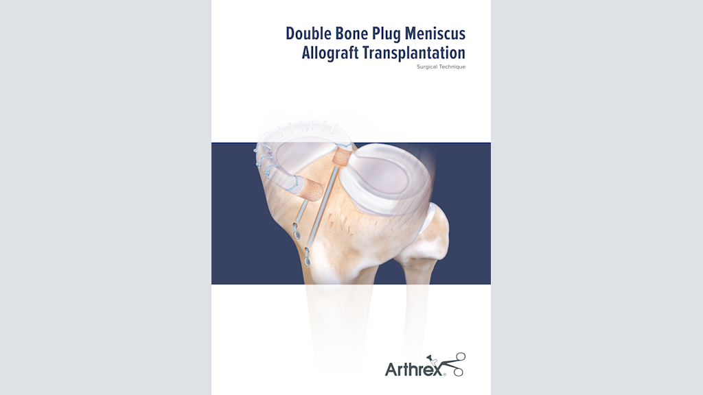 Double Bone Plug Meniscus Reconstruction