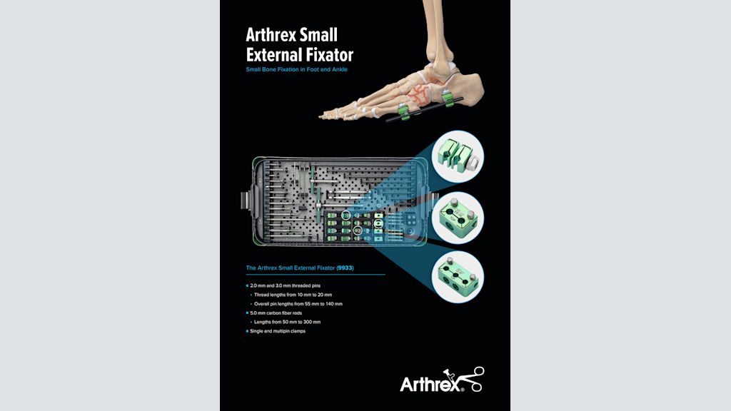 Arthrex Small External Fixator: Small Bone Fixation in Foot and Ankle