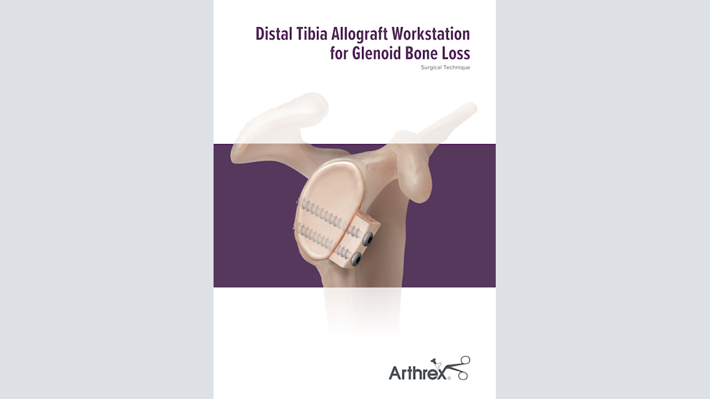Distal Tibia Allograft Workstation for Glenoid Bone Loss