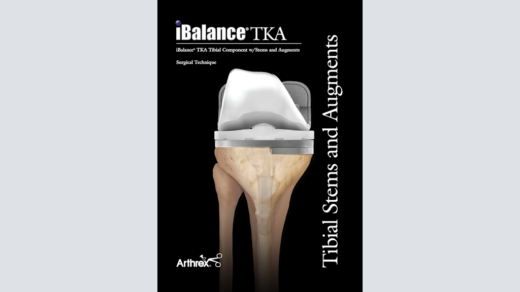 iBalance® TKA Tibial Component with Stems and Augments