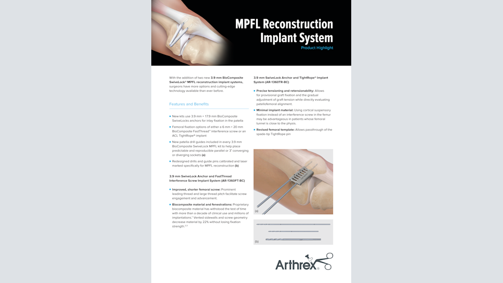 MPFL Reconstruction  Implant System
