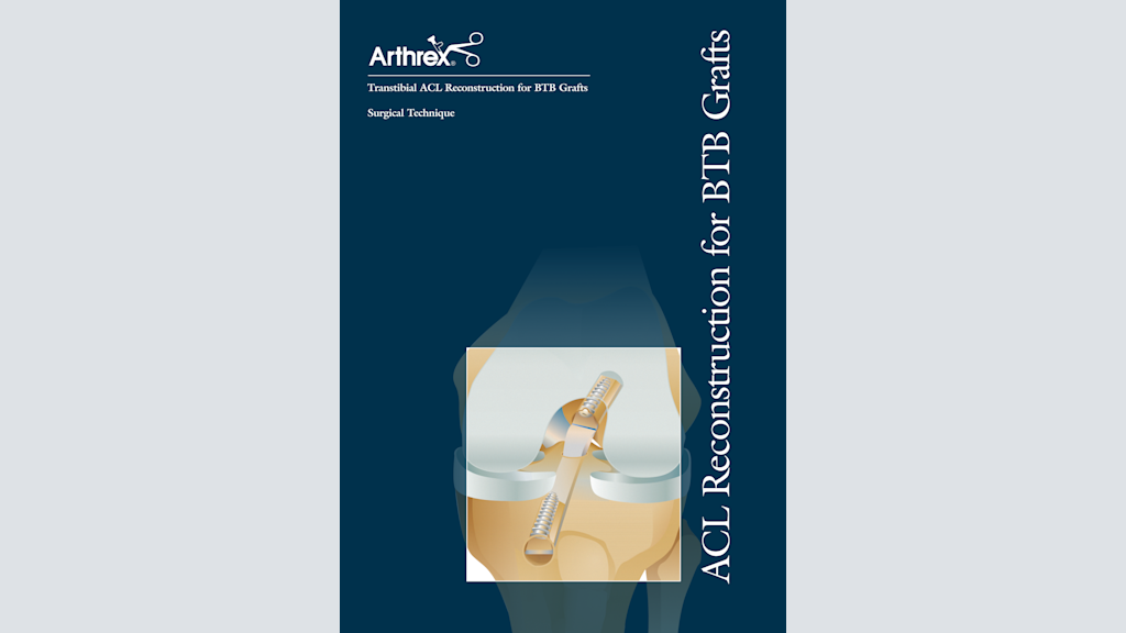 Transtibial ACL Reconstruction for BTB Grafts