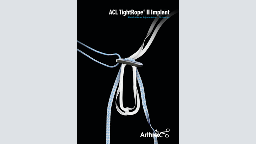 ACL TightRope® II Implant