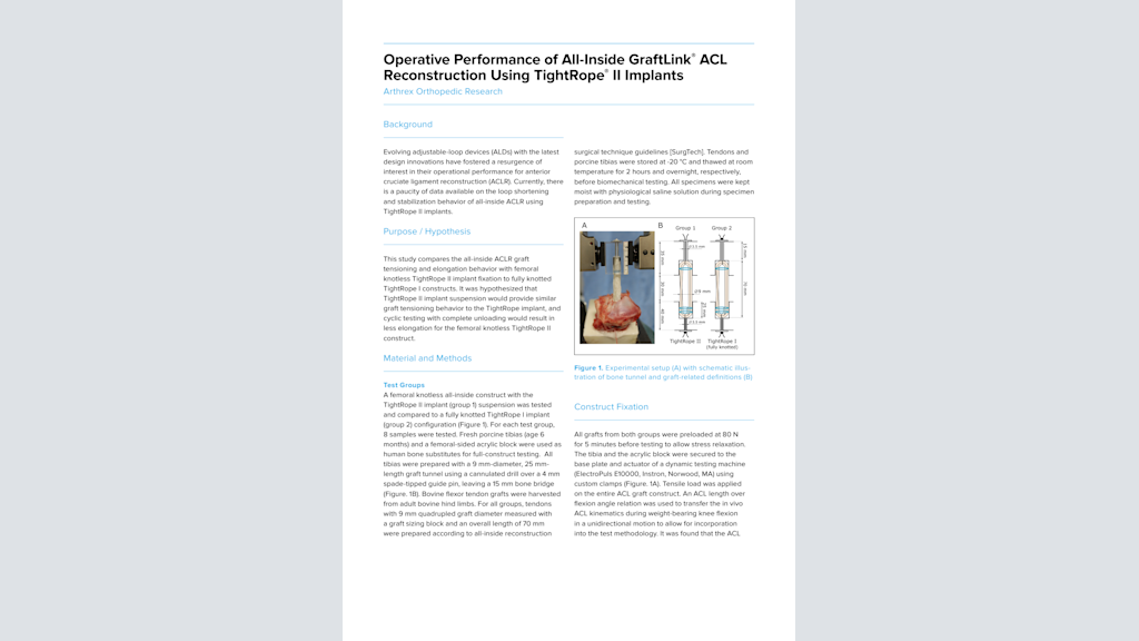 Operative Performance of All-Inside GraftLink® ACL Reconstruction Using TightRope® II Implants