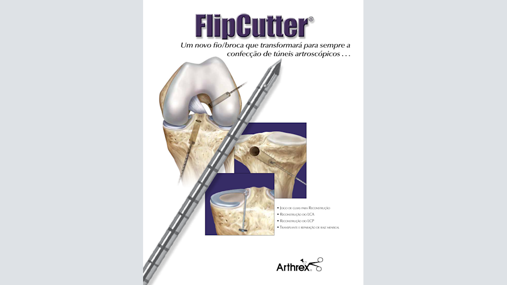 FlipCutter® - Um Novo Fio/Broca que Transformará para Sempre Confecção de Túneis Artroscópicos