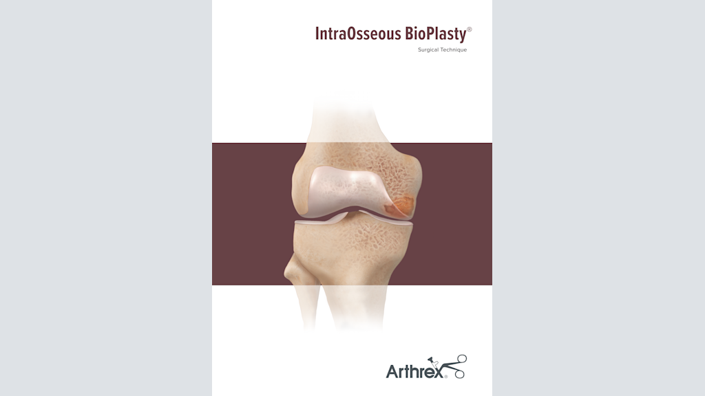 IntraOsseous BioPlasty®