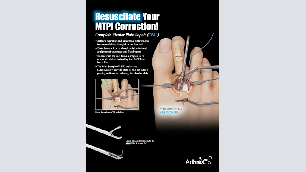 Resuscitate Your MTPJ Correction! - Complete Plantar Plate Repair (CPR™)