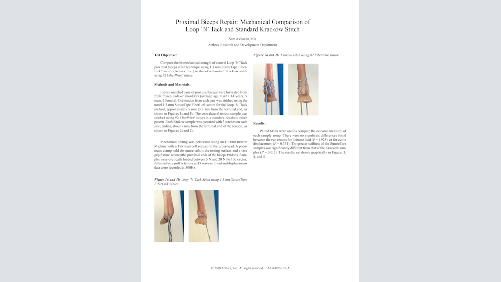 Proximal Biceps Repair: Mechanical Comparison of Loop ‘N’ Tack and Standard Krackow Stitch