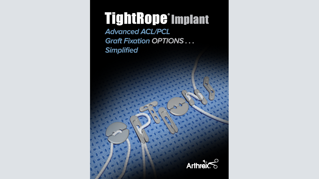 TightRope® Implant Advanced ACL/PCL Graft Fixation OPTIONS Simplified
