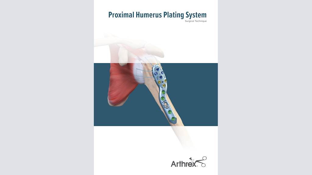 Proximal Humerus Plating System