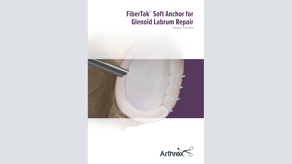 FiberTak® Soft Anchor for Glenoid Labrum Repair