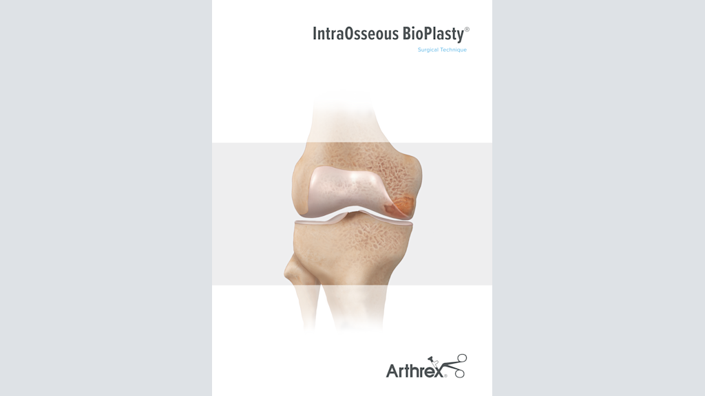 IntraOsseous BioPlasty® Surgical Technique