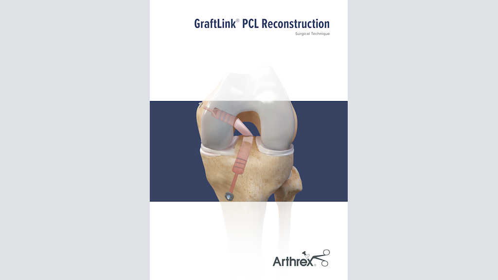GraftLink® PCL Reconstruction